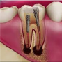 Endodontia